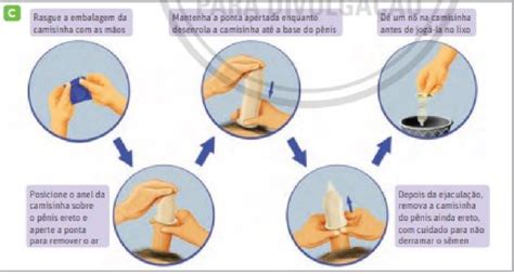 como coloca a camisinha|Camisinha: passo a passo para usar o preservativo。